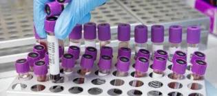 Welcome to the Edinburgh Reproductive Tissue Biobank (ERTBB)