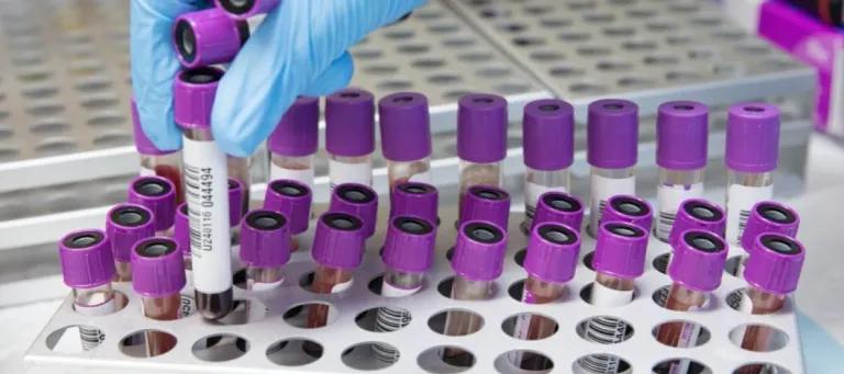 Welcome to the Edinburgh Reproductive Tissue Biobank (ERTBB)
