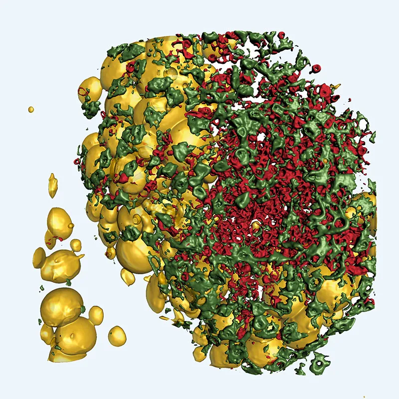 FALC cover cells (green), neutrophils in immune cell clusters in red, visceral adipose tissue (fat cells in yellow)