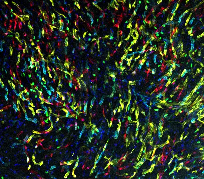 mouse model endothelial cells