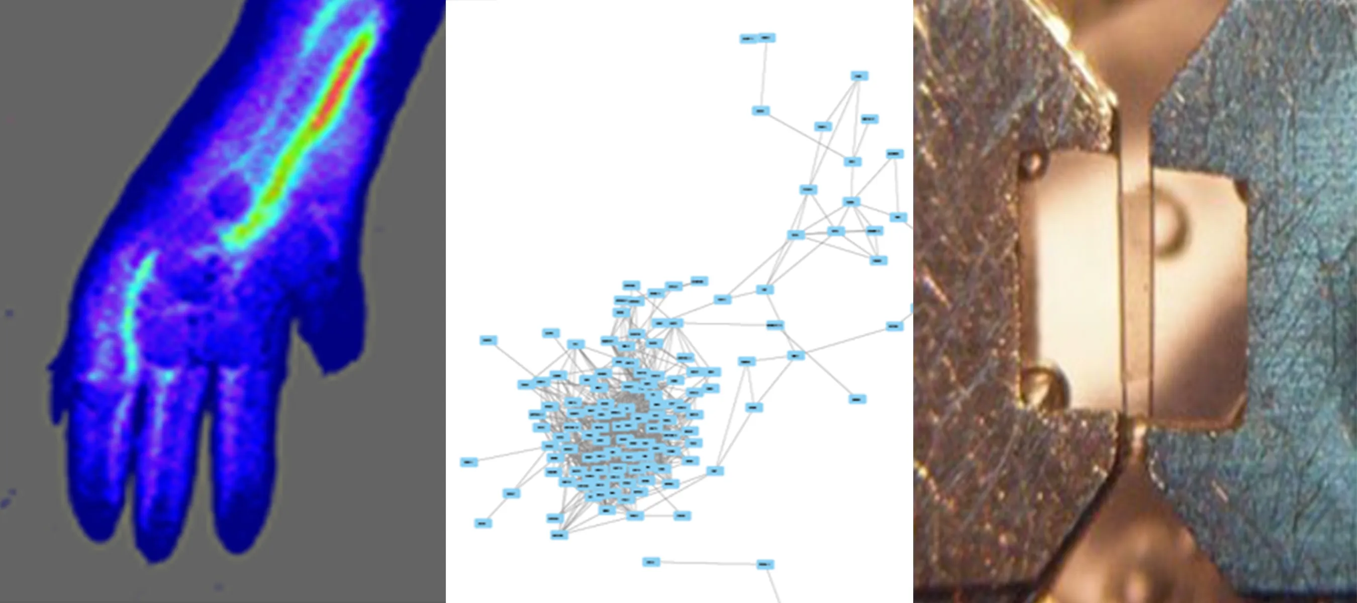 Combination of 3 images of Cardiovascular Injury, Repair & Regeneration
