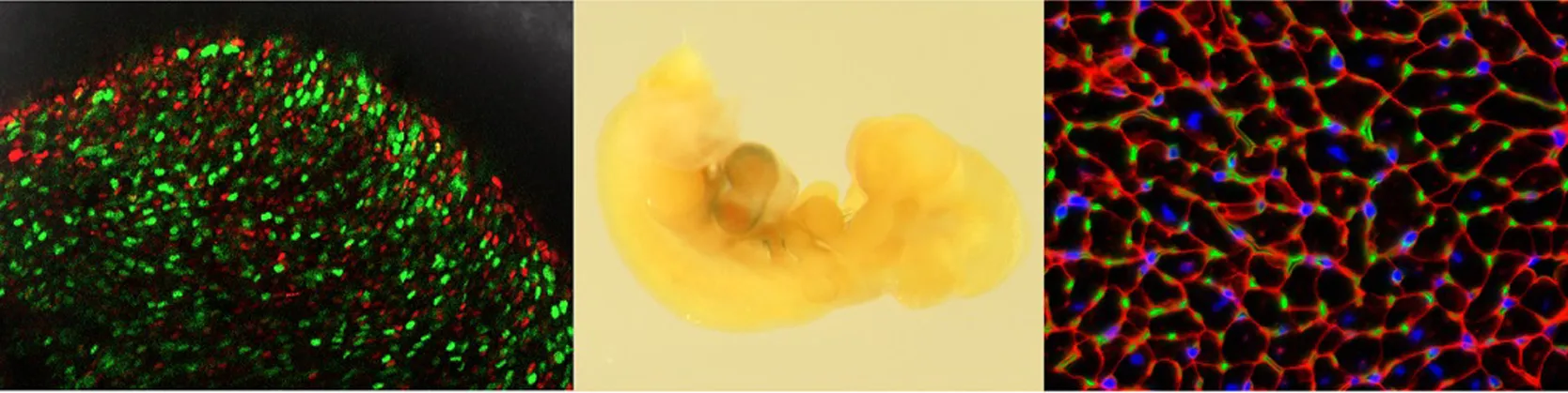 Combination of 3 images of glucocorticoids in early life