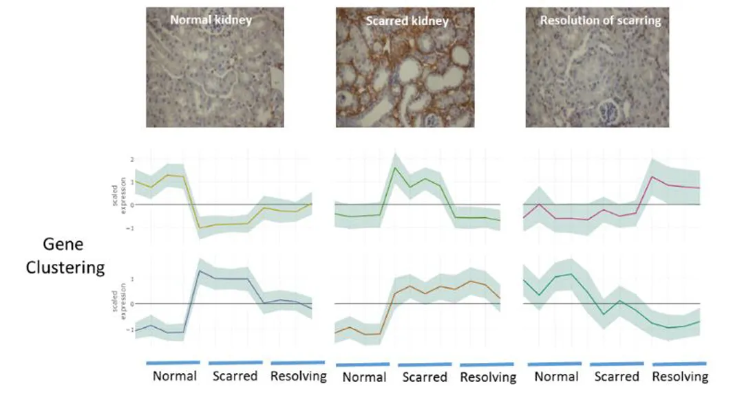 Combination of 3 images of the kidney (normal, scarred, resolution of scarring) along with 3 gene clustering graphs 