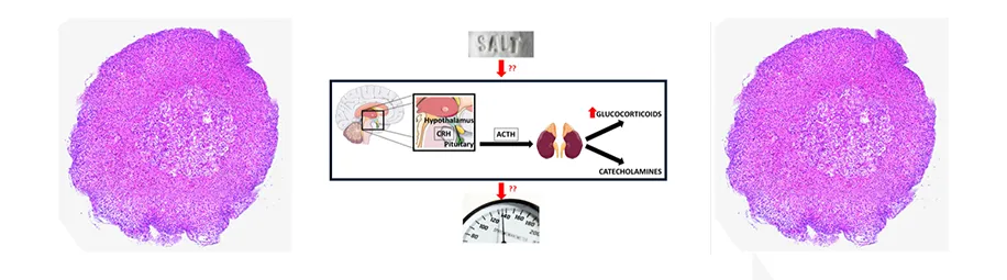 diagram of salt-glucocorticoid relationship