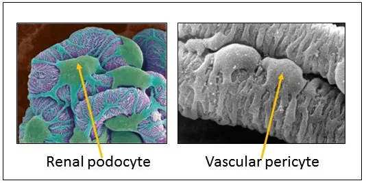 Combination of 2 images - one of a renal podocyte, one of a vascular pericyte