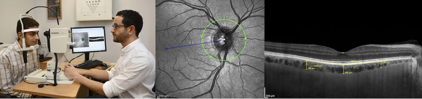 Combination of 3 images relating to OCT imaging research