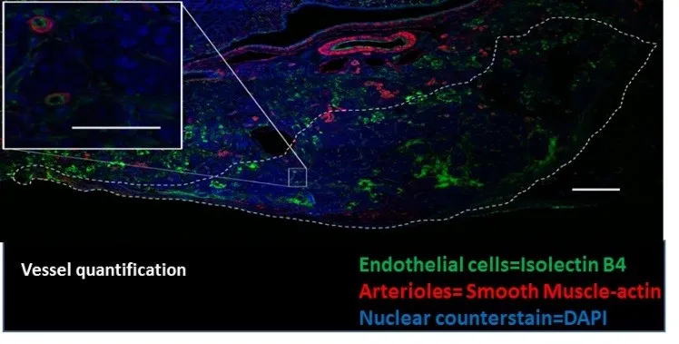 islet transplantation image