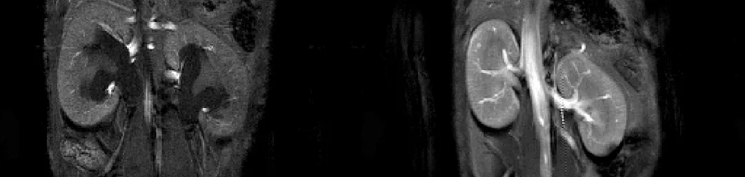 two images of the kidney