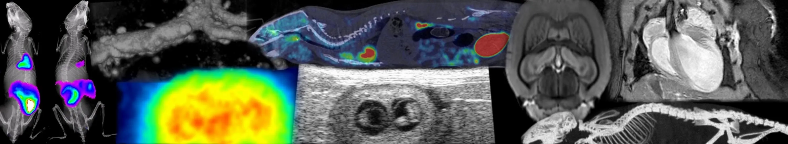 Combination of 9 Cardiometabolic Imaging images