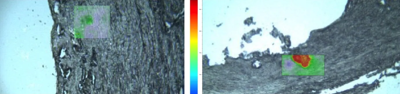 Engineered nanoparticles