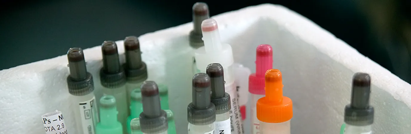 Image of various medical vials