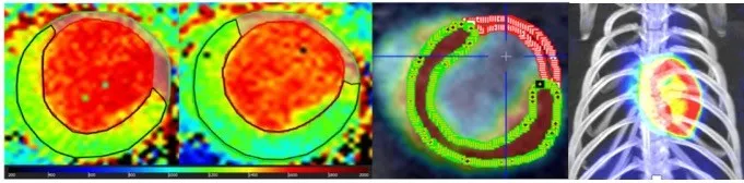 Combination of 4 MRI images