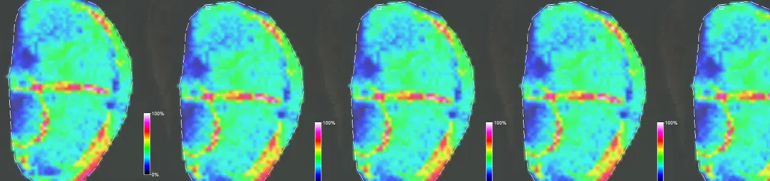 mass spec images of kidney tissue