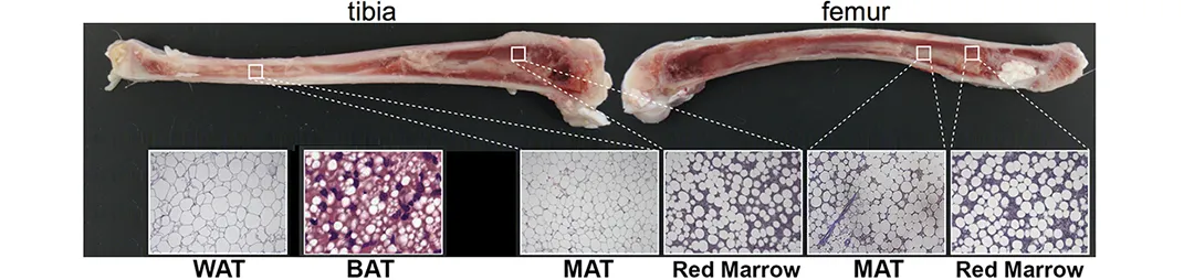 WAT and BAT of tibia and femur