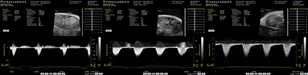 visual sonics graph and key