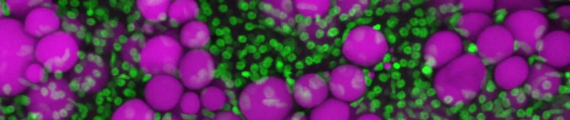 Zebrafish liquid droplets nuclei