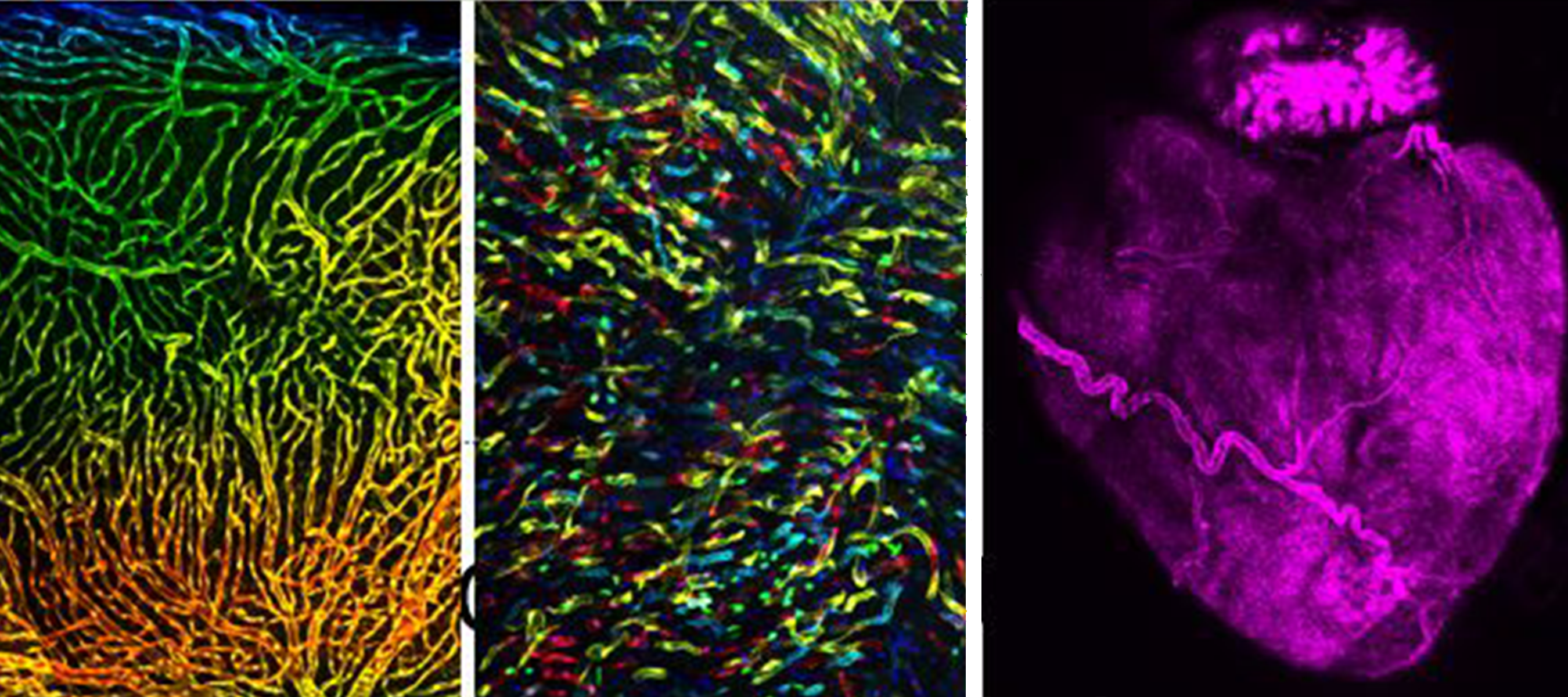 Combination of three images showing endothelial cells and heart muscle