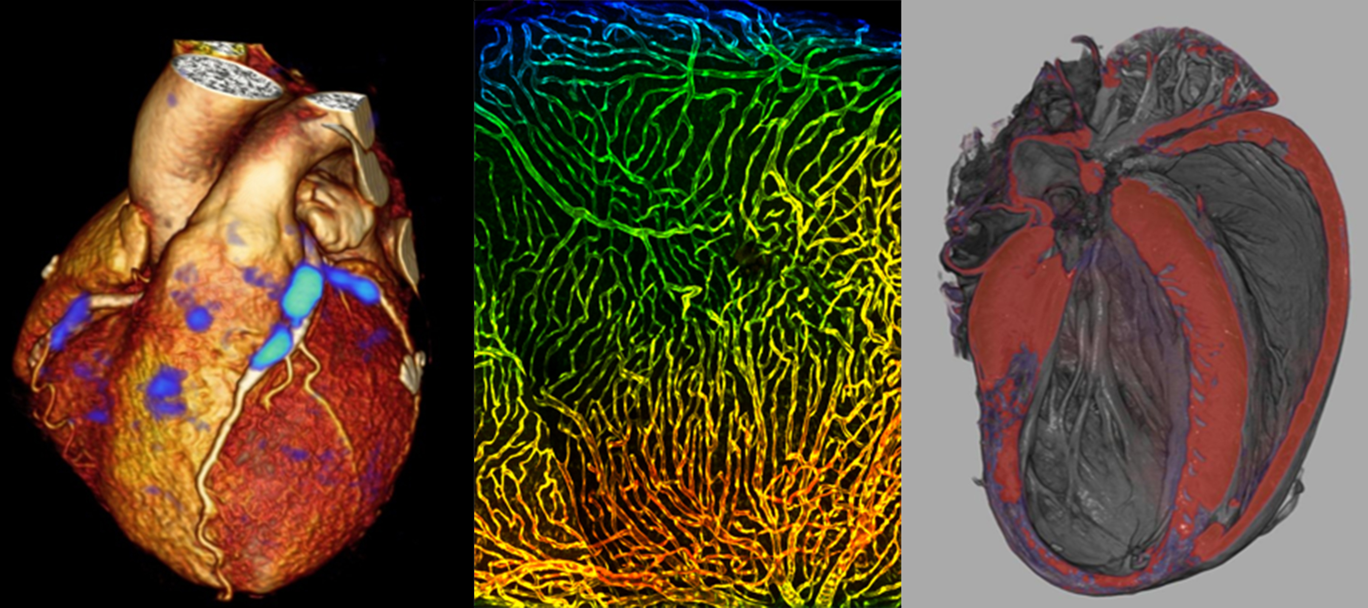 Combination of 3 images of Cardiovascular Injury, Repair & Regeneration