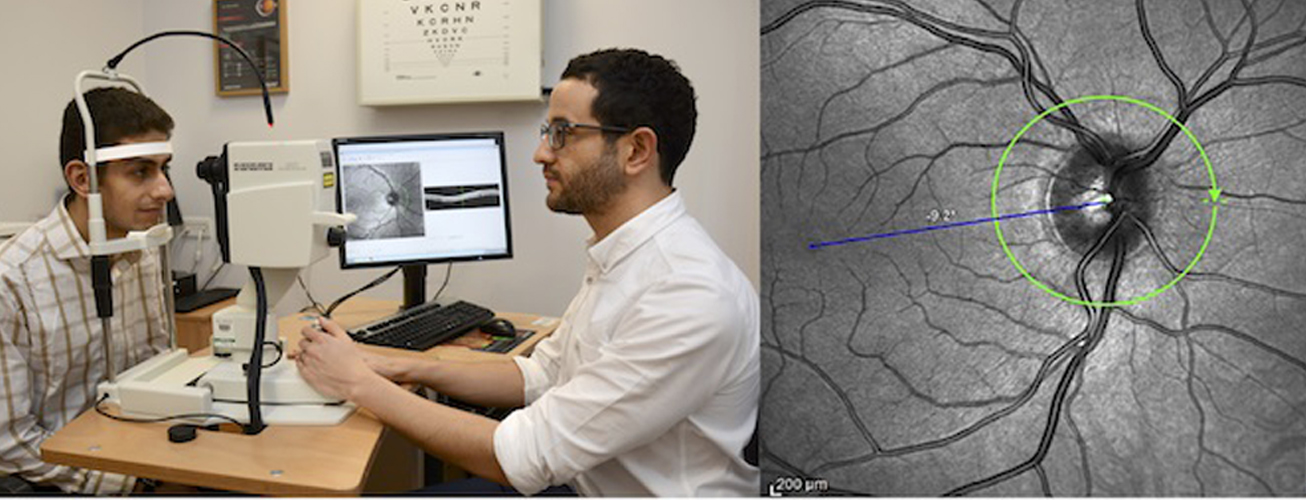 Retinal optical coherence tomography (OCT): using the eye as a window ...