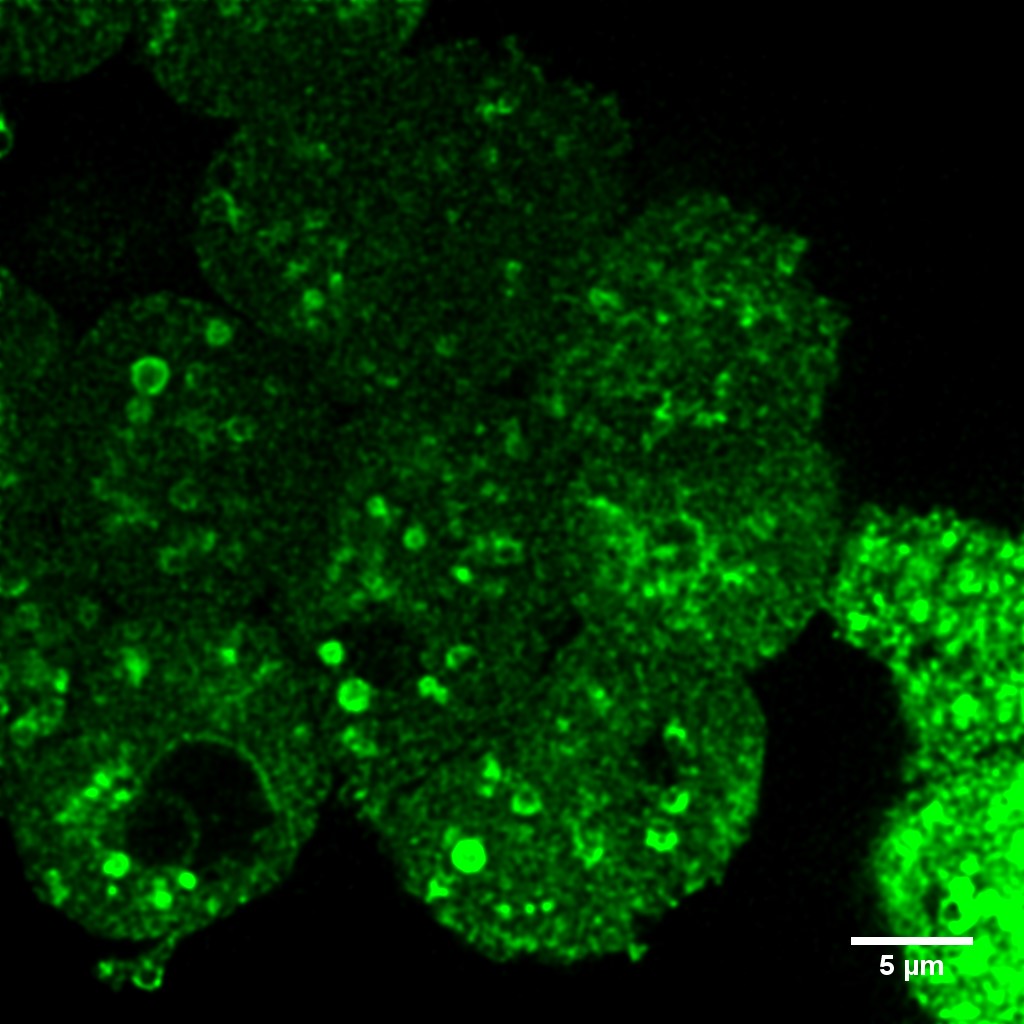 Cells within islet visualised using HiVolution
