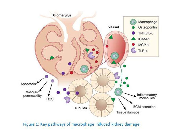 Key pathways of macrophage induced kidney damage