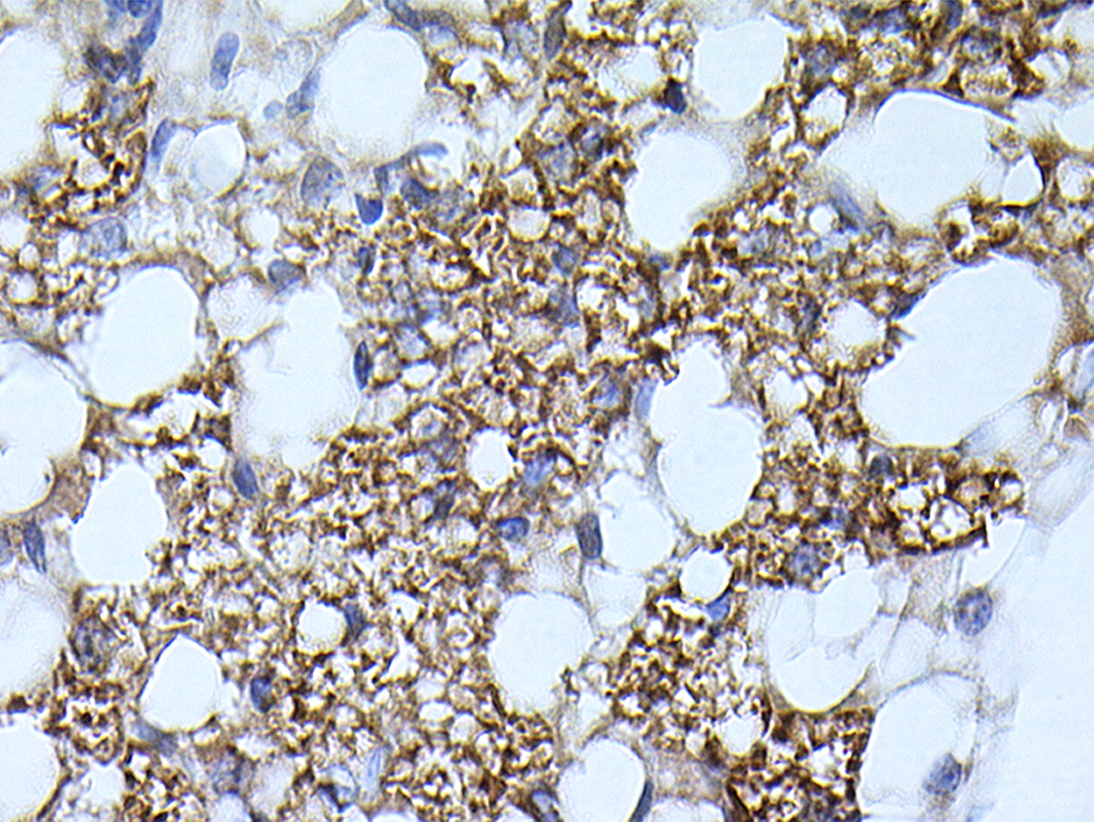 Brown adipose tissue as a novel therapeutic target for obesity and type ...